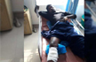 History-sheeter attacks constable, shot at in leg